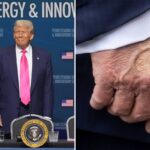 Trump kommt sauber, nachdem Fragen zu seinen geschwollenen Knöcheln und verletzten Hand aufgeworfen wurden