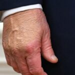 Die Gesundheitsängste von Donald Trump nehmen zu, als „starkes Make-up“ auf den Händen entdeckt wurde | Welt | Nachricht