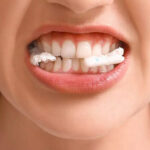 Warum laut Neurowissenschaften das Geräusch des Kauens, Klopfens oder Klickens Sie in den Wahnsinn treibt | Warum laut Neurowissenschaften das Geräusch des Kauens, Klopfens oder Klickens Sie in den Wahnsinn treibt |